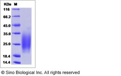 Sino Biological Recombinant Human IL-3 Protein (His Tag), Quantity: Each