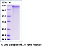 Sino Biological Recombinant Human NOTCH4 Protein (His Tag), Quantity: Each