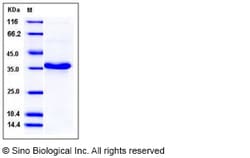 Sino Biological Recombinant Human HABP1/C1QBP/gC1qR Protein (His Tag),