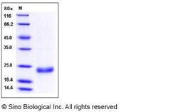 Sino Biological Human IFNL3 / IL28B / Interleukin-28B Protein (His Tag)