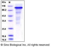 Sino Biological Recombinant Human IRE1 Protein (aa 465-977, His & GST Tag),