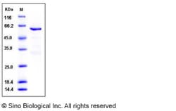 Sino Biological Recombinant Human MUSK Protein (aa 433-783, His & GST Tag),