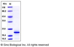 Sino Biological Human Complexin-2 / CPLX2 Protein (His Tag) 100ug, Quantity: