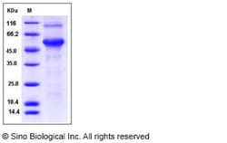 Sino Biological Human DMP1 Protein (His Tag) 100ug, Quantity: Each of 1