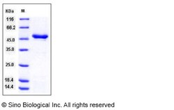 Sino Biological Human Tryptophan Hydroxylase 1 / TPH1 Protein (His Tag)