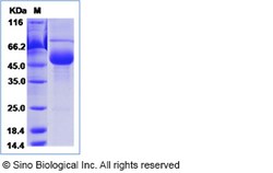 Sino Biological Recombinant Human FSH Beta Protein (hFc Tag), Quantity:
