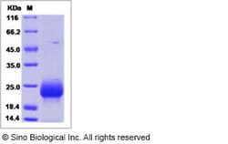 Sino Biological Recombinant Human FSH Beta Protein (His Tag), Quantity: