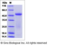 Sino Biological Recombinant Human IL17B Protein (hFc Tag), Quantity: Each