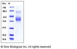 Sino Biological Recombinant Human SLAMF6 Protein (His Tag), HPLC-verified,