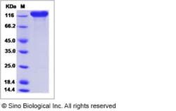 Sino Biological Human Siglec-2 / CD22 Protein (Fc Tag, ECD) 50ug, Quantity:
