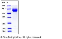 Sino Biological Recombinant Human ROBO4 Protein (His Tag), HPLC-verified,