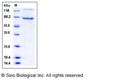 Sino Biological Recombinant Human DAPK1 Protein (aa 1-363, His & GST Tag),