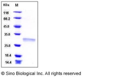 Sino Biological Recombinant Human RPE Protein (His Tag), Quantity: Each