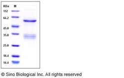 Sino Biological Human SUV420H2 Protein (His & GST Tag) 50ug, Quantity: