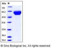 Sino Biological Human LILRB3 / LIR3 / ILT5 / CD85a Protein (His Tag), Biotinylated