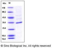 Sino Biological Recombinant Human FANCA Protein (His Tag), HPLC-verified,