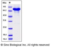 Sino Biological Human KEAP1 / INRF2 Protein (His & GST & AVI Tag) 100ug,