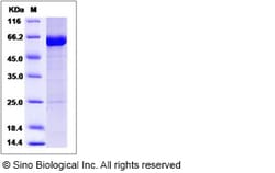 Sino Biological Recombinant Human KEAP1 Protein, HPLC-verified, Quantity: