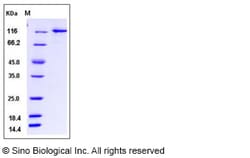 Sino Biological Recombinant Human Ubiquitin Activating Enzyme E1/UBA1 Protein