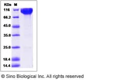 Sino Biological Recombinant Human c-Kit Protein (hFc Tag), HPLC-verified,