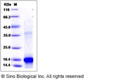 Sino Biological Recombinant Human c-Kit Protein (aa 50-190, His Tag), Quantity: