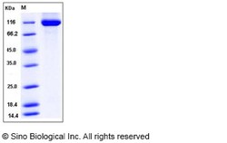 Sino Biological Recombinant Human RET Protein (His Tag), Quantity: Each
