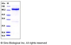 Sino Biological Recombinant Human RET Protein (aa 658-1114, His & GST Tag),
