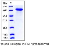 Sino Biological Recombinant Human GASP-1/WFIKKN2 Protein (His Tag), Quantity:
