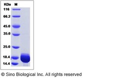 Sino Biological Human Galectin-7 / LGALS7 Protein (His Tag) 100ug, Quantity: