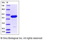 Sino Biological Human Galectin-7 / LGALS7 Protein (GST Tag) 100ug, Quantity: