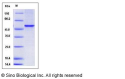 Sino Biological Recombinant Human Vitamin D Receptor/VDR Protein (His Tag),