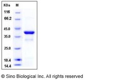 Sino Biological Recombinant Human IkB alpha Protein (His Tag), Quantity: