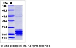 Sino Biological Recombinant Human IL-17A Protein (T26A, His Tag), Quantity: