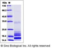 Sino Biological Human IL17 / IL17A Protein 5ug, Quantity: Each of 1