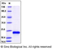 Sino Biological Human HRAS / GTPase Hras Protein (His Tag) 100ug, Quantity: