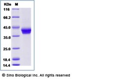 Sino Biological Recombinant Human GGH/Glutamyl hydrolase gamma Protein