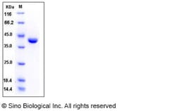 Sino Biological Recombinant Human Pepsinogen C/PGC Protein (His Tag), HPLC-verified,