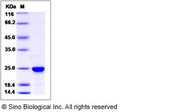 Sino Biological Human NRAS Protein (His Tag) 100ug, Quantity: Each of 1