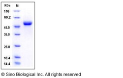 Sino Biological Recombinant Human GLA/alpha-Galactosidase A Protein (His