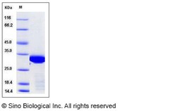 Sino Biological Human BCL6 / B-cell CLL lymphoma 6 Protein (aa 1-150, His