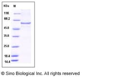 Sino Biological Human CAT / Catalase Protein (His Tag) 50ug, Quantity: