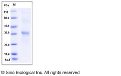Sino Biological Recombinant Human RGMA Protein (His Tag), HPLC-verified,