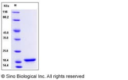 Sino Biological Recombinant Human alpha-Synuclein Protein, Quantity: Each