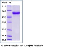 Sino Biological Recombinant Human DR3/TNFRSF25 Protein (hFc Tag), HPLC-verified,