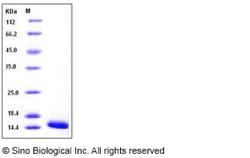 Sino Biological Recombinant Human FABP4/A-FABP Protein (29 Ala/Thr, His