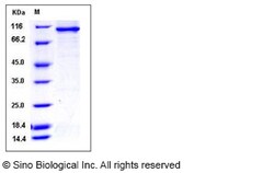 Sino Biological Recombinant Human SRPK3 Protein (His & GST Tag), Quantity: