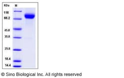Sino Biological Human LSAMP Protein (Fc Tag) 100ug, Quantity: Each of 1