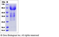 Sino Biological Recombinant Human Syndecan-3 Protein (ECD, His Tag), Quantity: