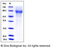Sino Biological Human TIM4 / TIMD4 Protein (His Tag) 100ug, Quantity: Each