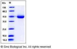 Sino Biological Recombinant Human VSIG4 Protein (His Tag), HPLC-verified,